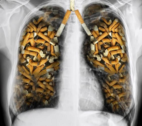 戒烟30年肺怎么样，戒烟30年身体的影响