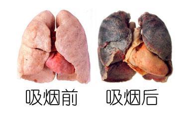 戒烟后的肺会怎么样图片，戒烟后的肺部改变图片
